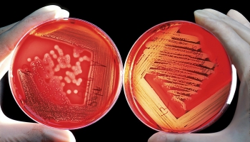 Стартап Conelum Biotech: "пометить" микроорганизмы с помощью искусственного интеллекта