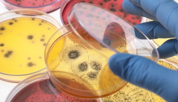Mutes mikrobioms var palīdzēt un arī traucēt uzturēt cilvēka gremošanas sistēmu veselu