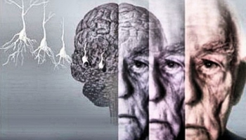 Деменция, депрессия, Альцгеймер и другие психические опасности старости