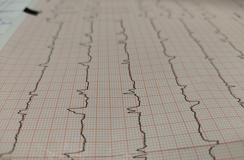 Kā atšķiras sievietes sirds darbība, un kas ietekmē tās veselību? Kā atšķiras sievietes sirds darbība, un kas ietekmē tās veselību?
