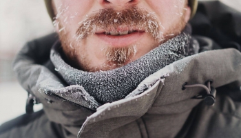 Kā kopt un pasargāt savu seju ziemas laikā?